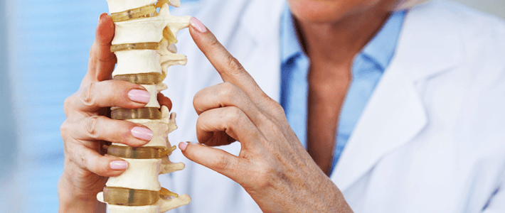 Prevenção e Tratamento da Osteoporose: o Guia Completo e Atualizado